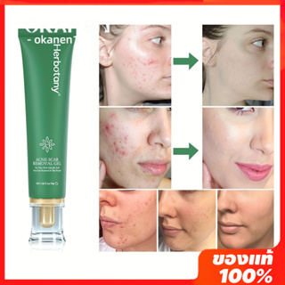 【Oken】รักษาสิว acne treatment Herbotany ครีมแต้มสิว กรดซาลิซิลิก ปกปิดสิวได้อย่างรวดเร็ว