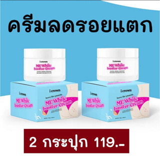ครีมลดรอยแตกแอนนา 2 กระปุก 119