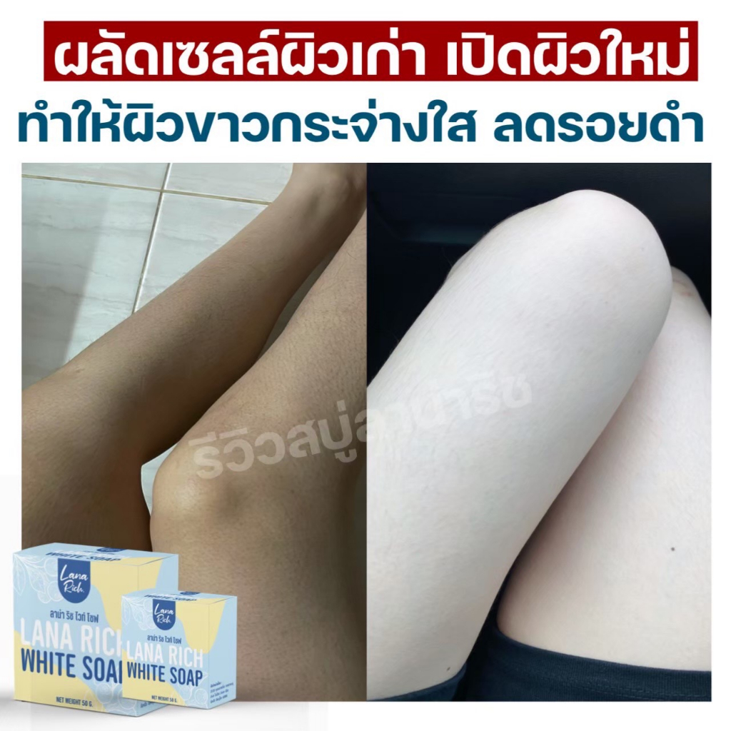 ขายดีมาก!! สบู่ลาน่า ริช LANA RICH WHITE SOAP รูปที่ 5