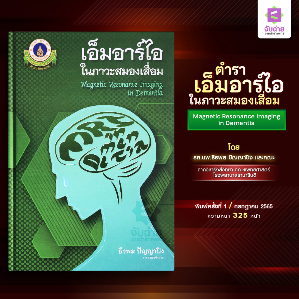 เอ็มอาร์ไอในภาวะสมองเสื่อม
