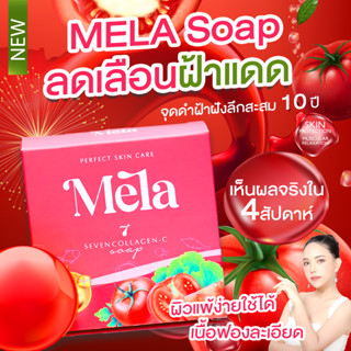 5ก้อน สบู่Mela ลบฝ้า สบู่หน้าเงา ฝ้าหลุด ล้างครั้งเดียวฝ้าจาง ลบทั้งฝ้า ทั้งสิว