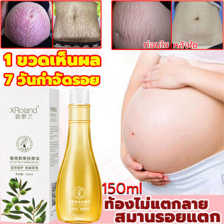 XRoland ครีมลดรอยแตก 150g ขาแตกลาย ลดรอยแตกลาย ครีมทาท้องลาย ครีมลดรอยแตกลาย แก้ท้องลาย กระชับผิวให้เรียบเนียน