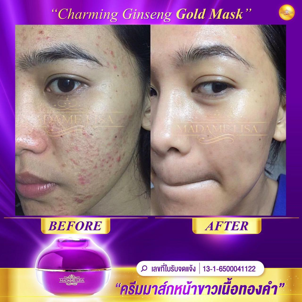 มาส์กหน้าสูตรทองคำ(sleeping mask)