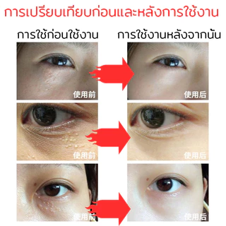 【ของแท้ พร้อมส่ง】ครีมบำรุงรอบดวงตา 20G ดูแลรอบดวงตาและ ครีมลดถุงใต้ตา ลดรอยคลำ้ใต้ตาลด ริ้วรอย