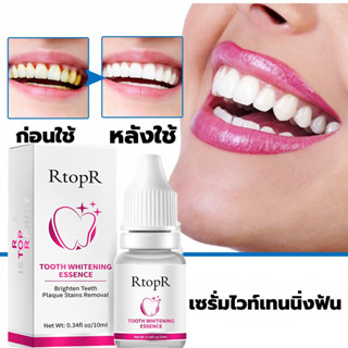 แท้💯% RtopR 10ml เอสเซนส์ฟอกฟันขาว ดูแลช่องปาก เอสเซ้นส์ฟอกสีฟัน สุขอนามัยช่องปาก ฟันเหลือง ลดกลิ่นปาก แปรงฟัน