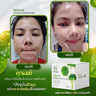 เซรั่มใบบัวบกของแท้ ครีมใบบัวบก ครีมใบบัวบกพรทิน่าแท้ เซรั่มใบบัวบกพรทิน่าของแท้ serum pontina แพ็กเกจใหม่