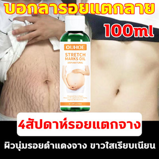 ครีมทาท้องลาย ผิวแตกลาย 100ml🔥แก้ท้องลาย ลดรอยแตกลาย ขาแตกลาย สะโพกลาย ผิวลาย รอยแตกลาย ครีมลดรอยแตกลาย ครีมกันแตกลาย