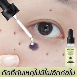 Katpmey ครีมทาฝ้า 30ml ลดฝ้ากระที่ฝังลึก กำจัดฝ้า จุดด่างดำ ฝ้า กระ กระจ่างใสผิว ลดเม็ดสีเมลานิน ครีมทาฝ้าลึก ครีมหน้า