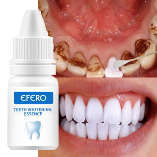 EFERO ฟอกฟันขาว เจลฟอกฟันขาว น้ํายาฟอกฟันขาว teeth whitening น้ํายาฟอกสีฟัน แก้ฟันเหลืองทำความสะอาดช่องปาลดกลิ่นปาก