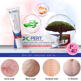 X-pert Allium Cepa plus gel ขนาด 10 กรัม (สารสกัดหัวหอมเข้มข้น+เพิ่มสาร Hyaluron) Xpert #10972