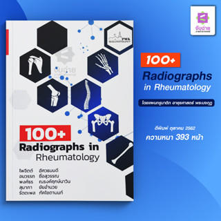 100+ Radiographs in Rheumatology