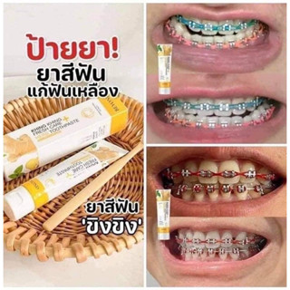 ยาสีฟันขิงขิง 1แถม1.