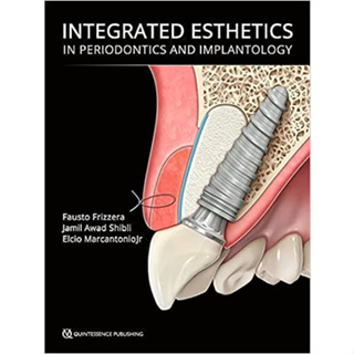 integrated Esthetics in Periodontics and Implantology (Hardcover)/Fausto Frizzera ISBN:9781786980984