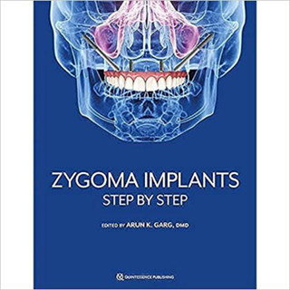 Zygoma Implants. Step By Step (Hardcover)/Arun K. Garg ISBN:9781647241575