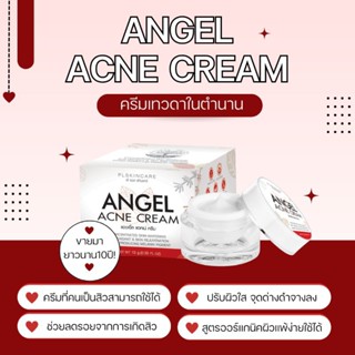 Angel Acne Cream แองเจิ้ล แอคเน่ ครีม ลดสิว รอยสิว บำรุงผิวหน้าเนียนนุ่มกระจ่างใส