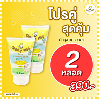 [ เซ็ตคู่เล็ก ] ลูกแพ้ยุง! ขาลาย! หายห่วง โลชั่นกันยุง ขนาด 50 Ml 2 ชิ้น Chicky Mild สูตรออร์แกนิค กันยุง ลดรอยดำ