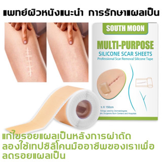 มีของพร้อมส่ง!! South Moon รักษารอยแผลเป็น แผ่นแปะแผลเป็น 4cm*150cm กําจัดรอยแผลเป็นจากแผลเป็น เผยผิวเนียนสวย