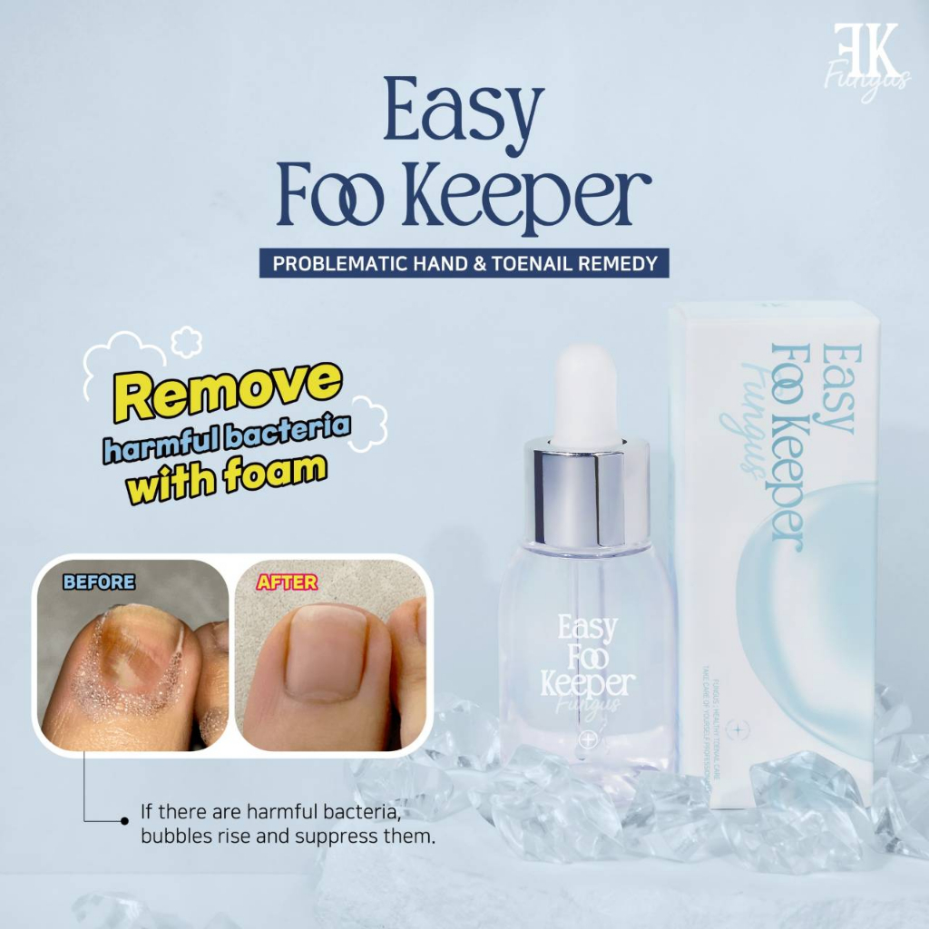 ผลิตภัณฑ์ขจัดเชื้อรา ฆ่าเชื้อแบคทีเรีย เล็บมือและเท้า Easy Foo Keeper สินค้ายอดนิยม นำเข้าจากเกาหลี พร้อมส่ง