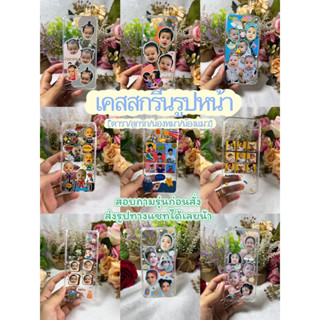 เคสสกรีนรูป[ออกแบบฟรี]