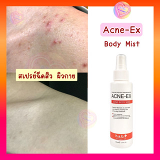 สเปรย์ฉีดสิว ใช้ดี รีวิวเพียบ (ของเเท้) Acne ex body spray 120 ml. (MK008) Acne-ex