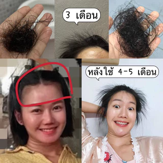 แชมพูสมุนไพรสด 1 ขวด ขนาด 500 ml สมุนไพรสด 13 ชนิด