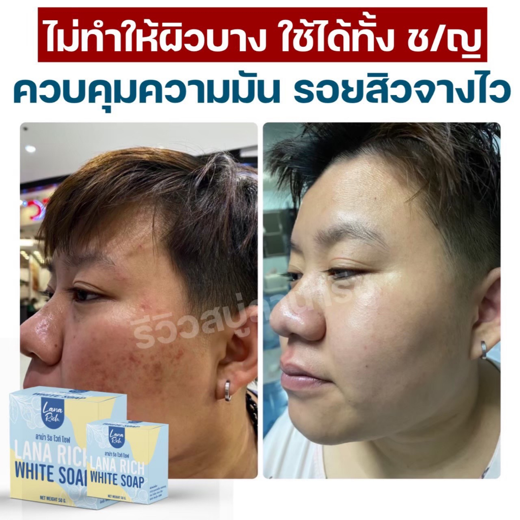 ขายดีมาก!! สบู่ลาน่า ริช LANA RICH WHITE SOAP รูปที่ 7