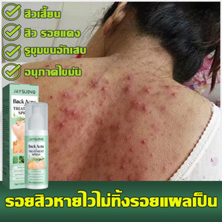 Jaysuing 120ml สิวที่หลัง แอคเน่ สเปรย์ฉีดแผ่นหลังและลำตัว ลดไรและสิวตามร่างกาย กำจัดสิวที่หลังและลำตัว ครีมแต้มสิว