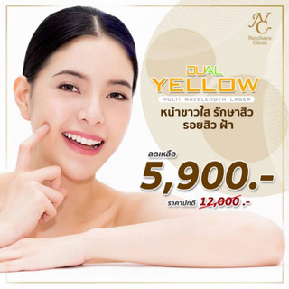 Dual Yellow หน้าขาวใส รักษาสิว รอยสิว ฝ้า ที่ Natchaya Clinic [Gift Voucher]