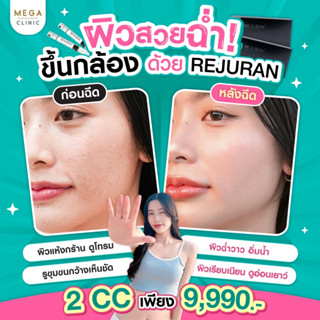 [E-voucher] REJURAN ฟื้นฟูผิว หลุมสิวดูตื้น รูขุมขนกระชับ ผิวฉ่ำแบบสาวเกาหลี MEGA CLINIC เมกะคลินิก