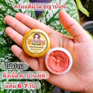 ครีมไฝชญานันท์ขมิ้นวานห่างจระเข้ ไฝ ขี้แมลงวัน ติ่งเนื้อ หูด ตาปลา ปาน จบทุกปัญหา