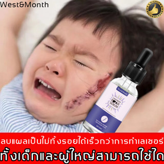 ลบรอยแผลเป็นแบบมืออาชีพ West&amp;Month ครีมลบแผลเป็น แผลไฟไหม้ แผลผ่าตัด บาดแผล ครีมทาแผลเป็น เหมาะสำหรับรอยแผลเป็นทุกชนิดปล