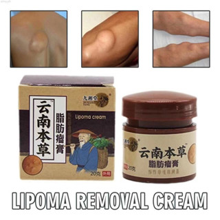 Lipoma Removal Cream กำจัดรวดเร็ว ติ่งเนื้อ ครีมทาเนื้องอกไขมัน สลายก้อนเนื้อใต้ผิวหนัง  กำจัดก้อนเนื้อแข็ง 20g