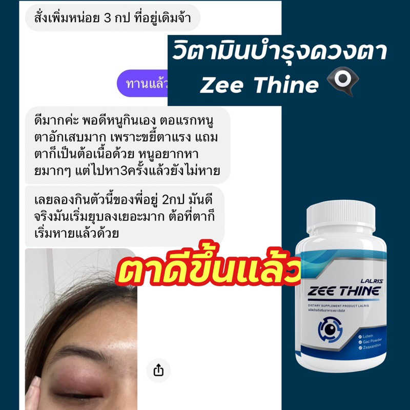 ซีทีนวิตามิน-Zee Thine  ️บำรุงตา บำรุงสายตา สารสกัด ลูทีน บิลเบอรี่ Lutein Bilberry ซีแซนทีน Vitamin บำรุงดวงตา สายตา ราคา ถูกที่สุด ดีลบีเคเค แกลเลอรีภาพที่ 6