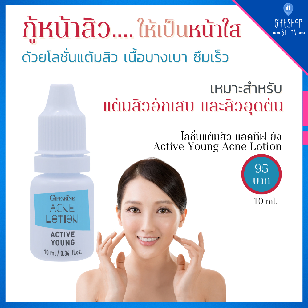 โลชั่น แต้มสิว แอคทีฟ ยัง กิฟฟารีน แต้มสิววัยรุ่น ลดการอักเสบ ลดการระคายเคือง ยับยั้งแบคทีเรีย Active Young Acne Lotion