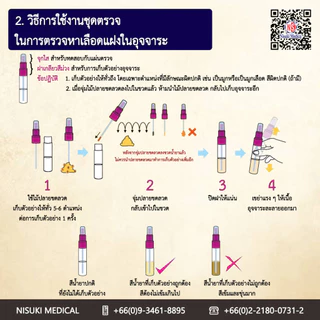 ชุดตรวจคัดกรองมะเร็งลำไส้ด้วยอุจจาระ เลข อย. 66-2-2-1-0002514 ขนาดบรรจุ 1 ชุดทดสอบ