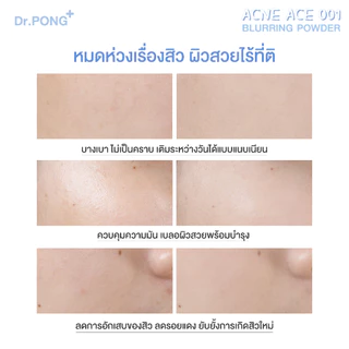 Dr.PONG ACNE ACE 001 แป้งไม่ผสมรองพื้น สูตรลดสิว - ZincPCA - Niacinamide Tranexamic acid - Tea Tree oil