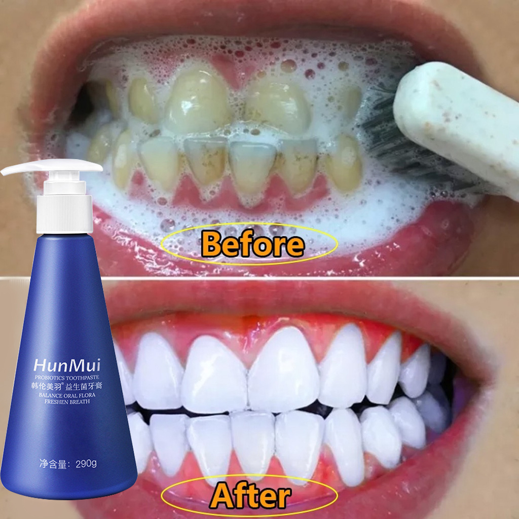 ฟอกสีฟัน ยาสีฟันฟันขาว Teeth Whitening 290g ลมหายใจสดชื่น ซ่อมฟันเหลือง ขจัดคราบหินปูน​ กำจัดกลิ่นปาก ลดครบหินปูน