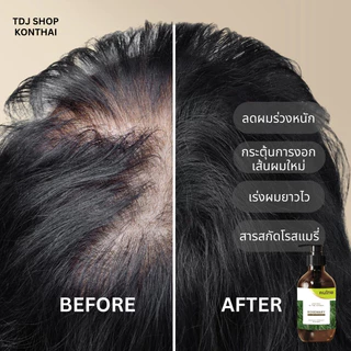 แชมพูลดผมร่วงหนักโรสแมรี่ เหมาะสำหรับคนเป็น longcovid ปลูกผม ลดผมร่วง shampoo rosemary ขนาด 280 ml.