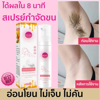 สเปรย์กำจัดขน 100ml ขนบิกินี่ มูสกำจัดขน กำจัดขนอย่างอ่อนโยน ไม่ทำร้ายผิว ครีมกำจัดขน ครีมกำจัดขนถาวร ยับยั้งขนขึ้