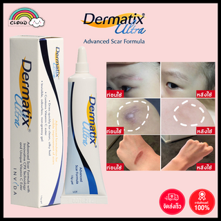 【แท้100%】 Dermatix Ultra Gel 15g เดอร์มาติกซ์ อัลตร้า เจล ครีมลดรอยแผลเป็น ครีมรักษาแผลเป็น ครีมลบรอยแผลเป็น ครีมทาแผลเป็น รักษารอยแผลเป็น