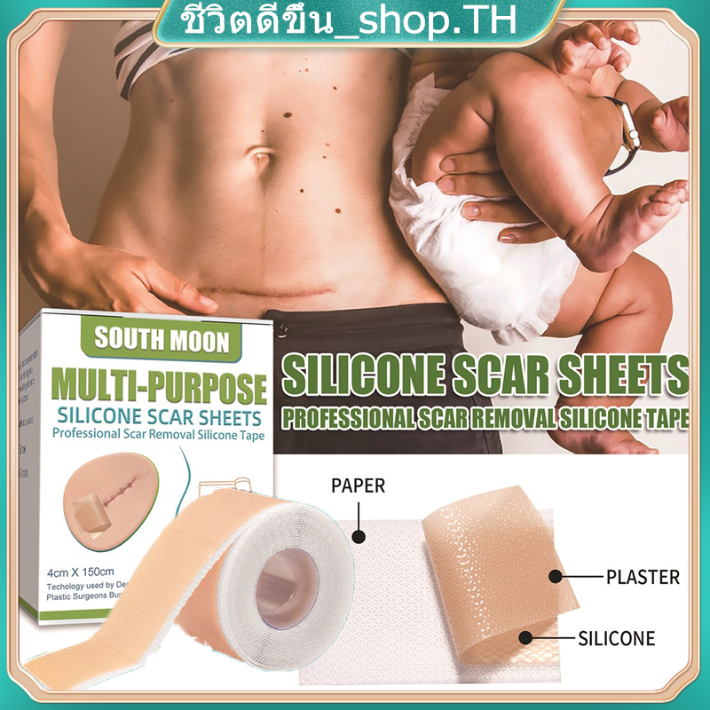 【 พร้อมส่ง】South Moon รักษารอยแผลเป็น รักษารอยแผลเป็น แผ่นแปะแผลเป็น 4cm*150cm กําจัดรอยแผลเป็นจากแผลเ