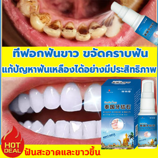 เอาหินปูนออกใน 1 วินาที️น้ำยากำจัดหินปูน30ML ขจัดคราบหินปูน น้ำยากำจัดหินปูน ยาสีฟันฟอกฟันขาว กําจัดนิ่วในฟัน ยาสีฟันฟัน