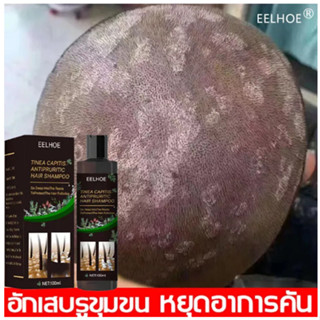 EELHOE แชมพูขจัดรังแค แชมพูคัน แชมพูยาเชื้อรา 100ml ขจัดรังแค หยุดอาการคัน ลดผมร่วง ยาสระผมขจัดรังแค ดูแลหนังศีรษะ