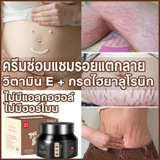 ครีมลดรอยแตกลาย ลดรอยแตกลาย ครีมลบรอยแผลเป็น 50g ลดรอยไหม้ น้ำร้อนลวก แผลผ่าตัด รอยแผลเป็นจากสิว ซ่อมแซม รอยแตกลาย