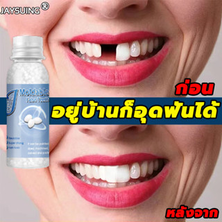 🦷อุดฟัน 30ml ทำฟันเองที่บ้าน🦷ฟันปลอมของแท้ ซ่อมฟันชั่วคราวครอบฟันถอดได้ กาวฟันปลอม แทนฟันที่หายไป​🚚ส่งจากไทย