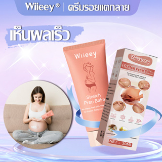 【รีแพทย์แนะนำ】 Wiieey ครีมรอยแตกลาย สำหรับการซ่อมแซมผิวหลังคลอด รอยแตกลาย ร่องไขมัน ลดรอย ครีมลดลอยเเตก ครีมทาผิว