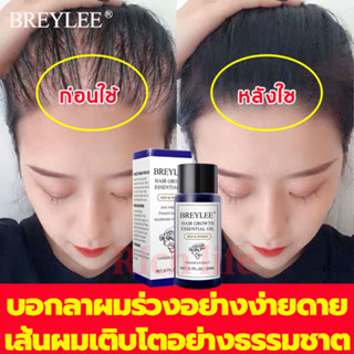 เซรั่มบำรุงผม20ml สารสกัดจากขิง น้ำยาปลูกผม เซรั่มปลูกผม น้ำยาปลูกผมดกHair Essence ซ่อมแซมผมเสีย เร่งผมยาว ป้องกันผมร่วง