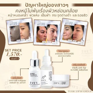 เซ็ทผิวขาวกระจ่างใสไร้ริ้วรอย