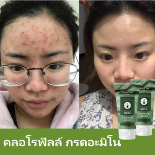 โฟมล้างหน้าลดสิว กรดอะมิโน ครีมล้างหน้า คลอโรฟิลล์ คลีนเซอร์ 100ml ควบคุมความมัน กําจัดสิว  กําจัดสิวหัวดํา กระชับรูขุมข