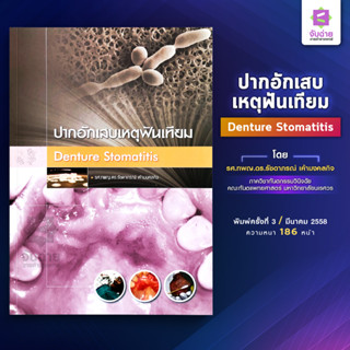 ปากอักเสบเหตุฟันเทียม (Denture stomatitis)